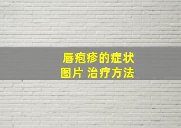 唇疱疹的症状图片 治疗方法